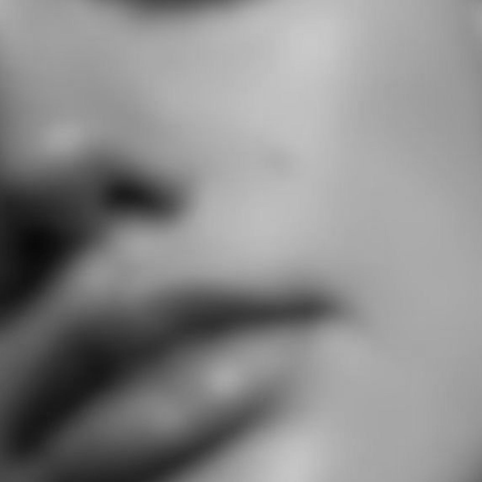 Sensitive Skin Treatments | Expert Care at Injxu Face + Skin