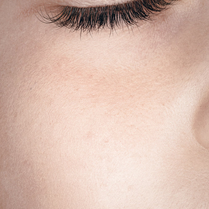 Holistic Skin Rejuvenation for Women in Their 30s and 40s: Why Potenza RF Is a Game Changer