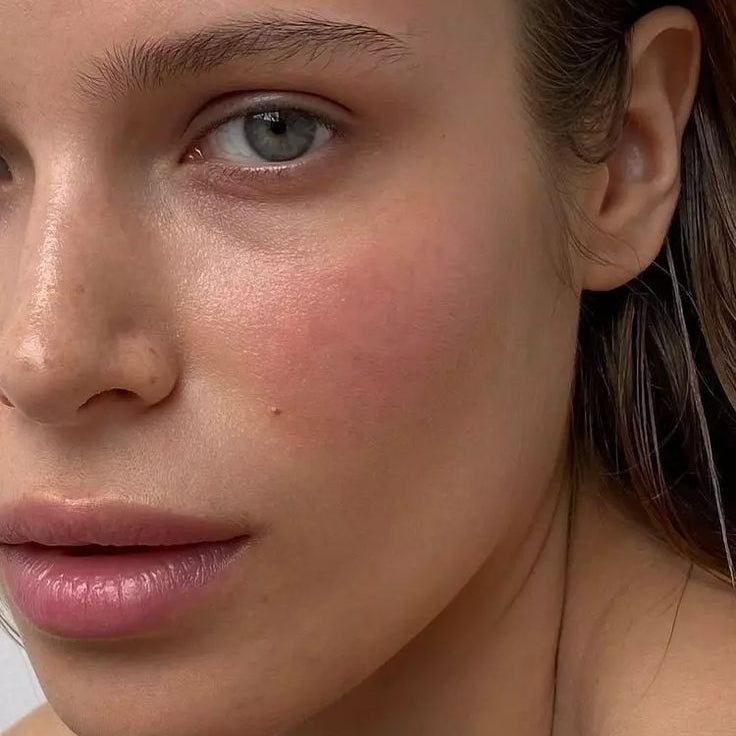 Featured In: Spa + Clinic, "A Jab To Reduce Rosacea"