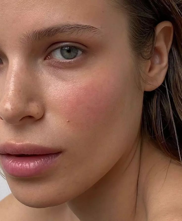 Featured In: Spa + Clinic, "A Jab To Reduce Rosacea"