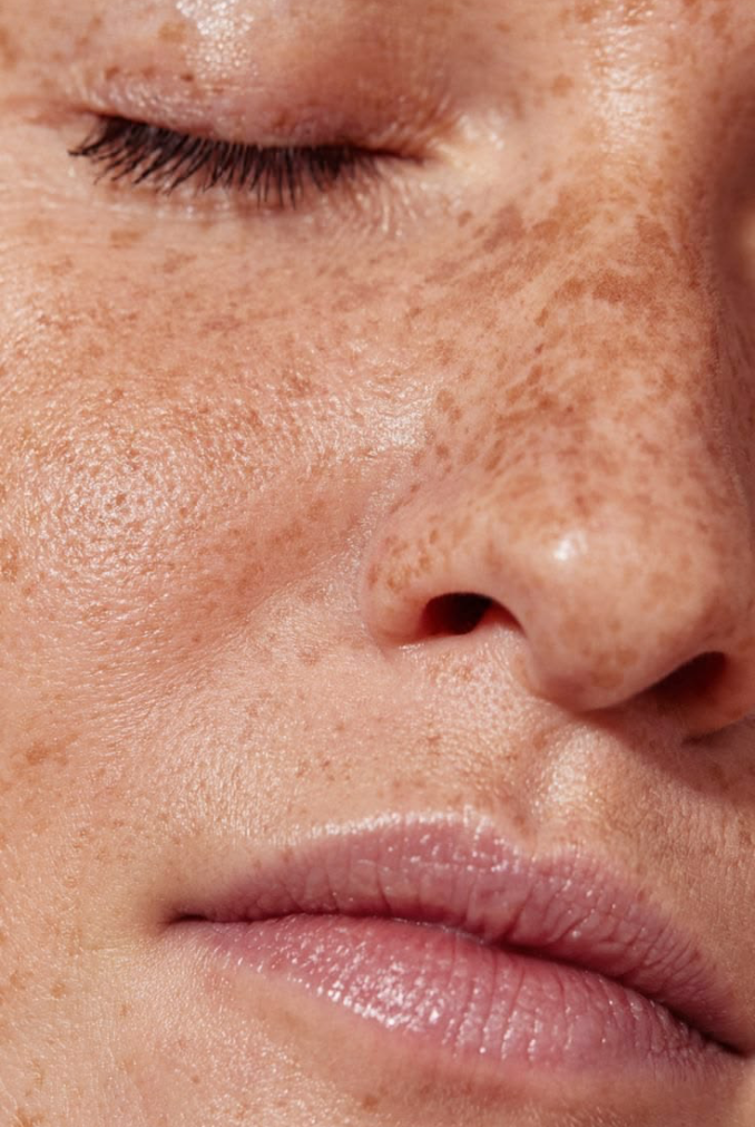Sun Damage Repair in Sydney: What Actually Works, and When to Start