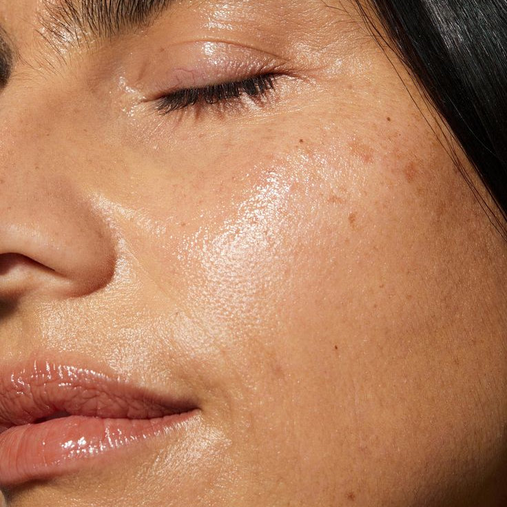 Holistic Skin Rejuvenation for Women in Their 30s and 40s: Why Potenza RF Is a Game Changer