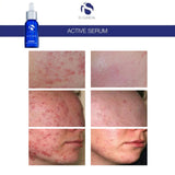 iS Clinical Active Serum