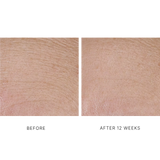 InterFuse Treatment Cream Face & Neck