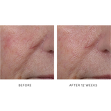 InterFuse Treatment Cream Face & Neck