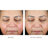 Trio Luxe Moisture Treatment