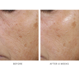 Trio Rebalancing Moisture Treatment