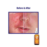 iS Clinical Pro-Heal Serum Advance+