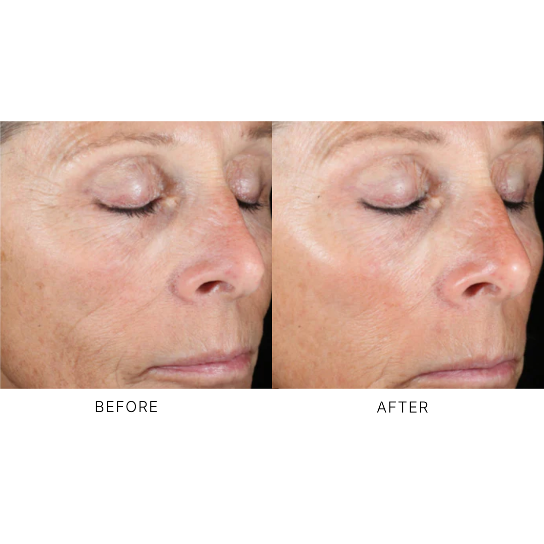 iS Clinical Active Peel System