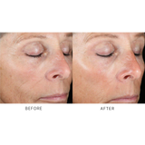 iS Clinical Active Peel System
