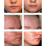 iS Clinical Active Serum