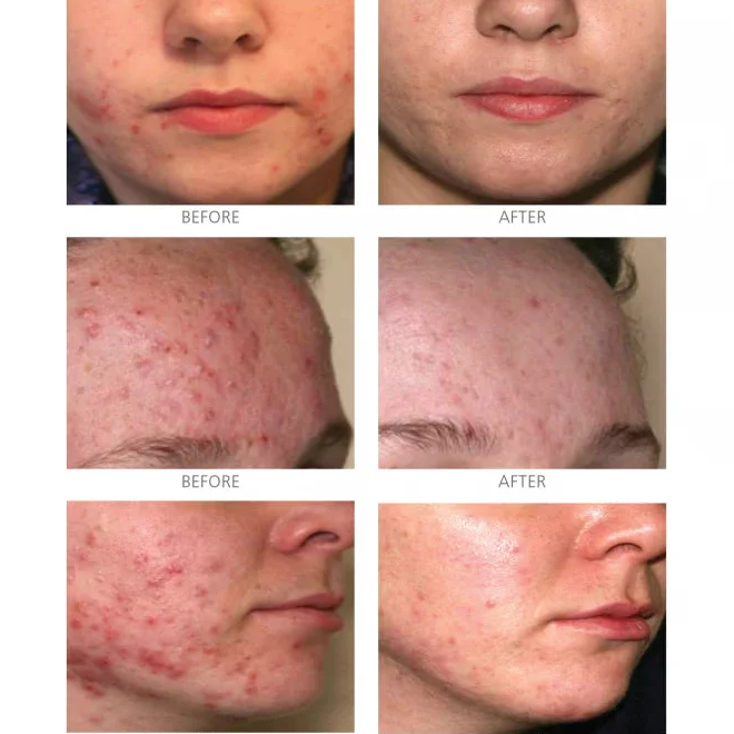 iS Clinical Active Serum