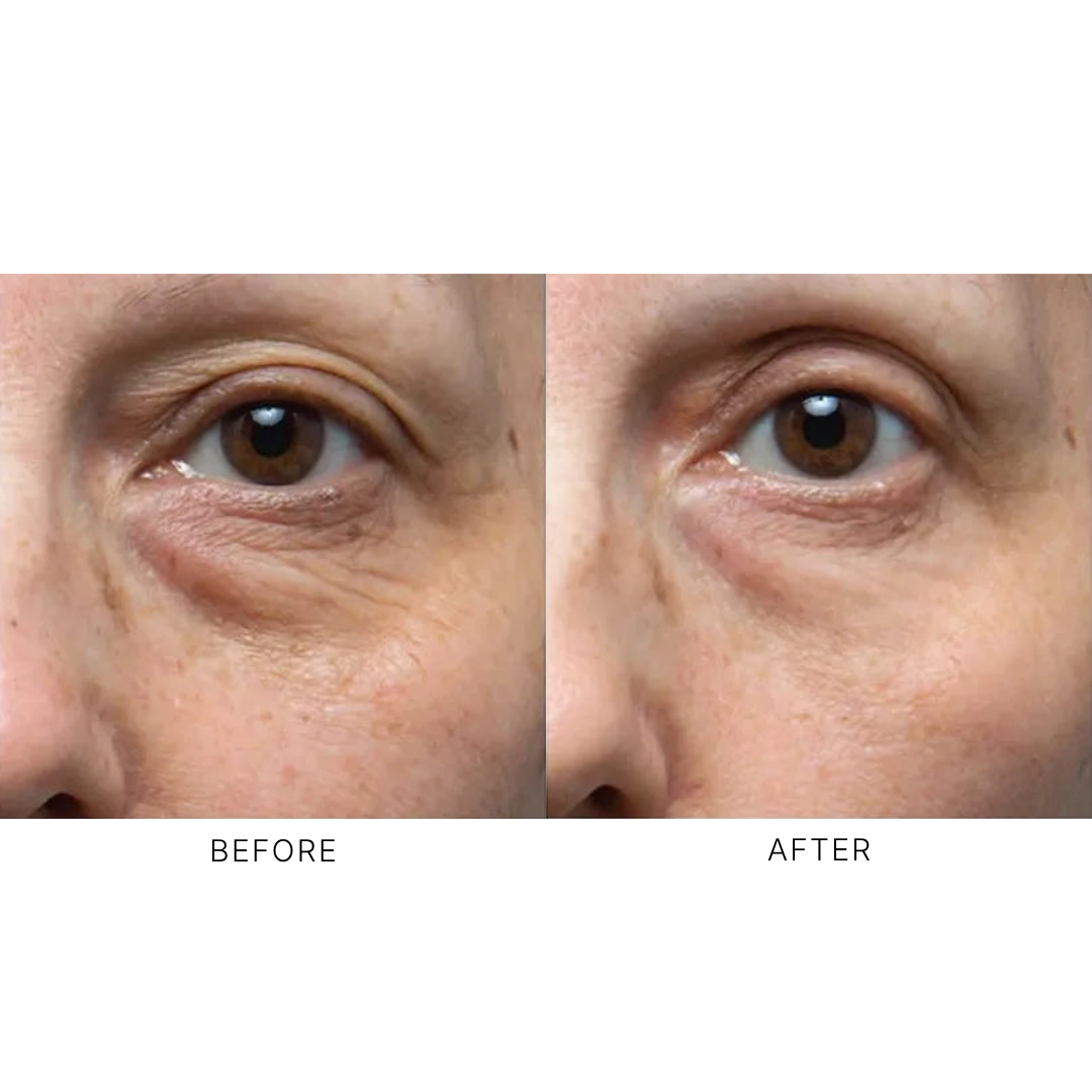 iS Clinical C Eye Serum Advance+