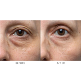 iS Clinical C Eye Serum Advance+