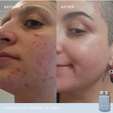 Vida Glow Advanced Repair - Clear