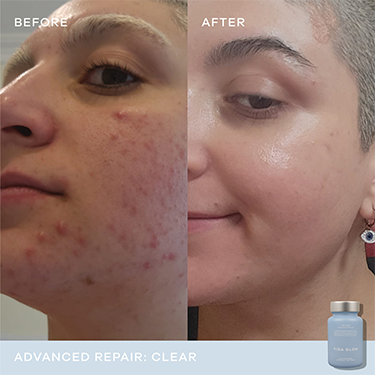 Vida Glow Advanced Repair - Clear