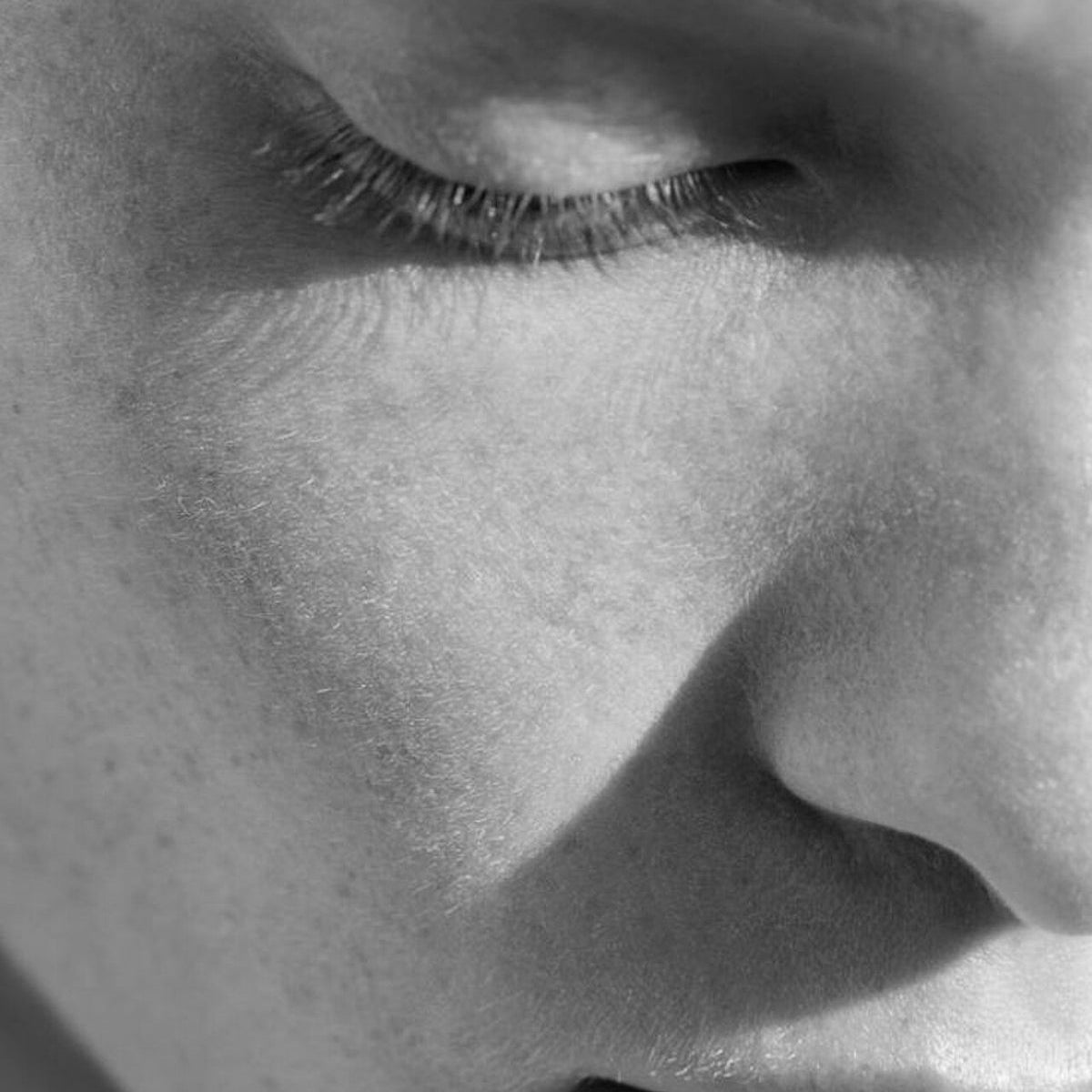 Black and white close up of a woman’s face with eyes closed, highlighting smooth skin texture and natural features that reflect the results of refined cosmetic treatments.
