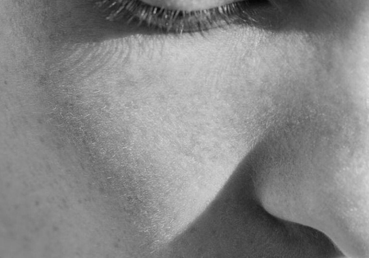 Black and white close up of a woman’s face with eyes closed, highlighting smooth skin texture and natural features that reflect the results of refined cosmetic treatments.
