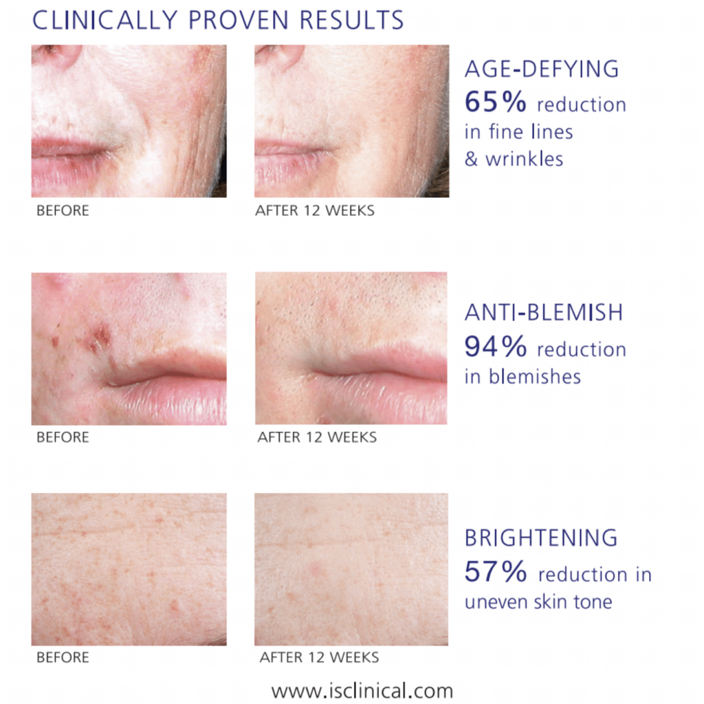 iS Clinical Active Serum