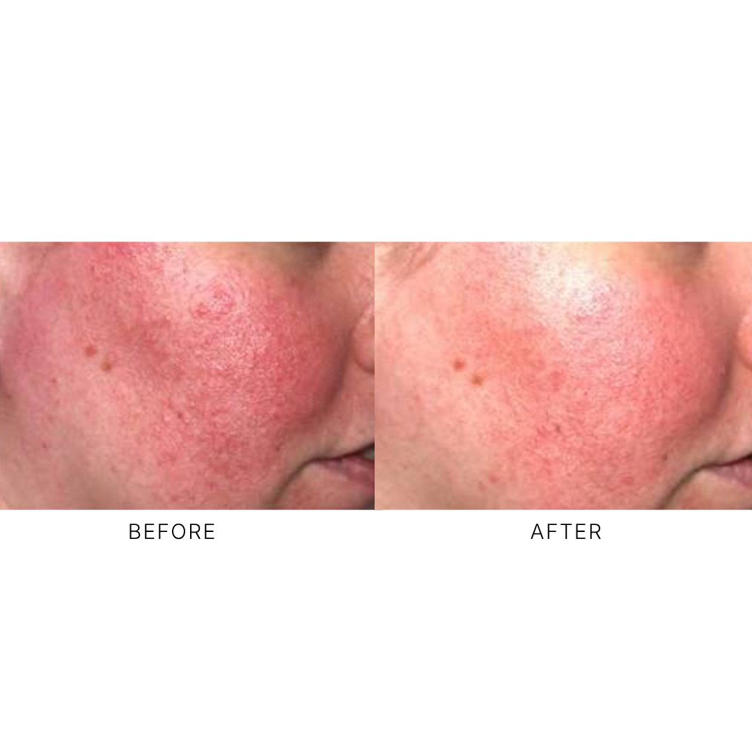 iS Clinical Pro-Heal Serum Advance+