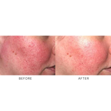 iS Clinical Pro-Heal Serum Advance+