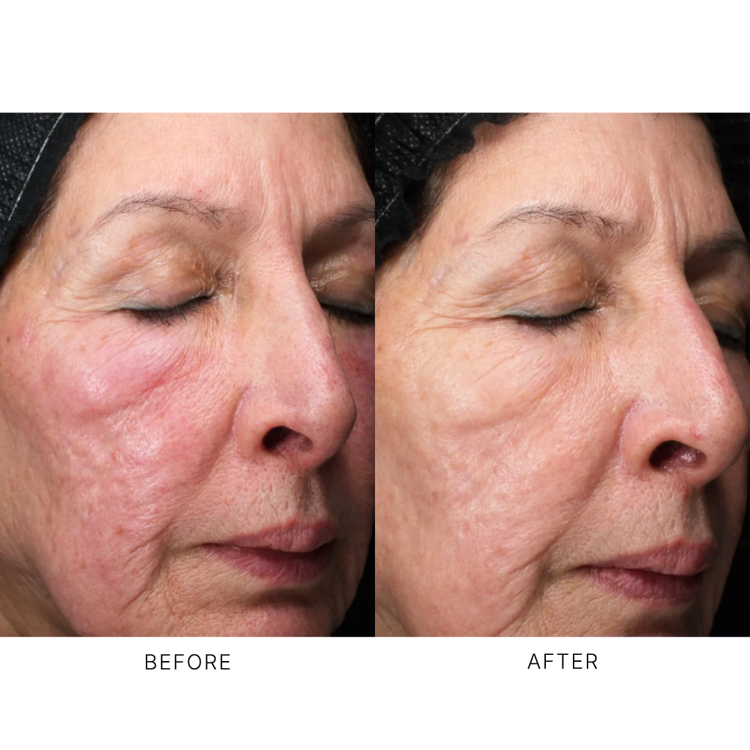 iS Clinical Retinol+ Emulsion 0.3
