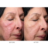 iS Clinical Retinol+ Emulsion 0.3