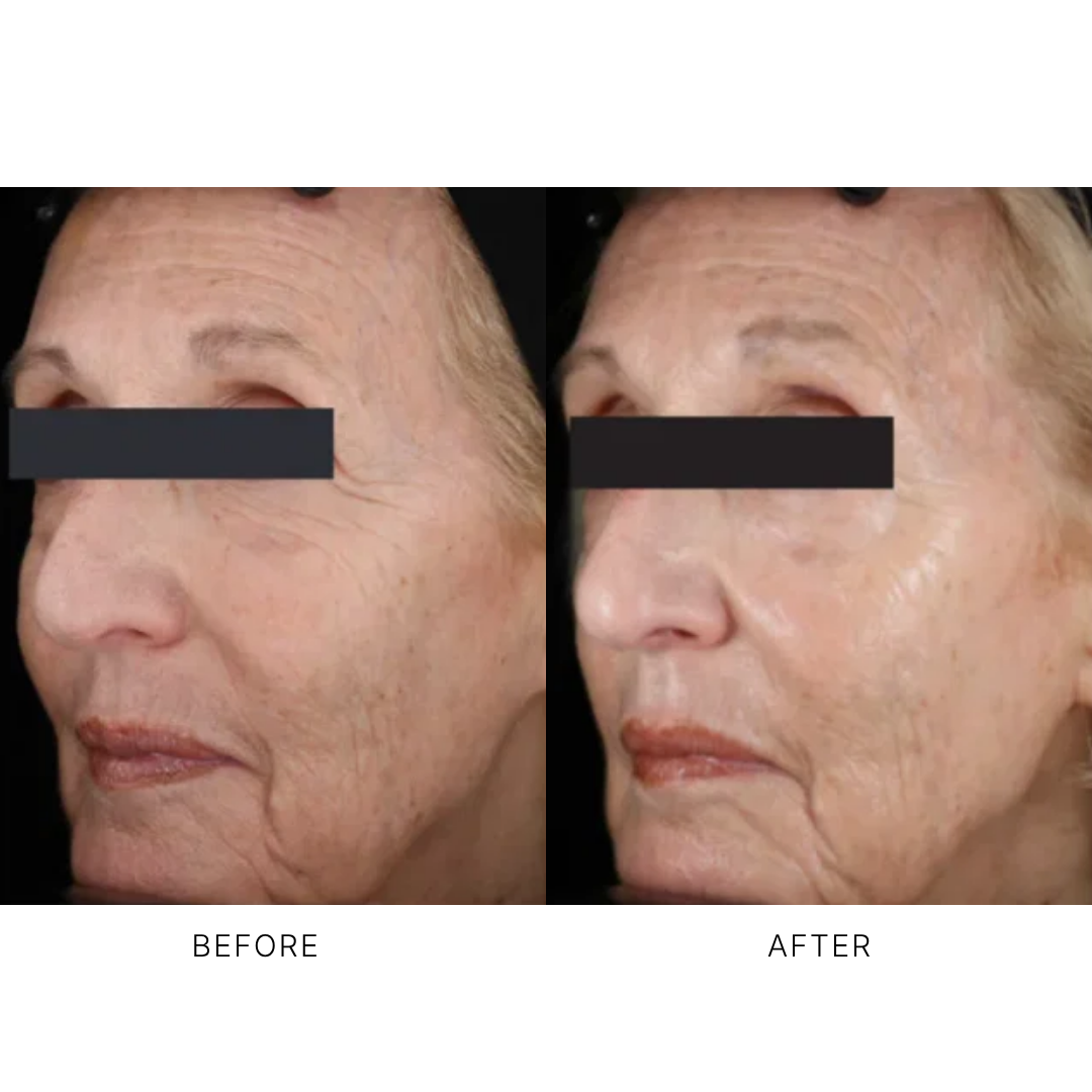 iS Clinical Youth Eye Complex