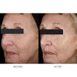 iS Clinical Youth Eye Complex