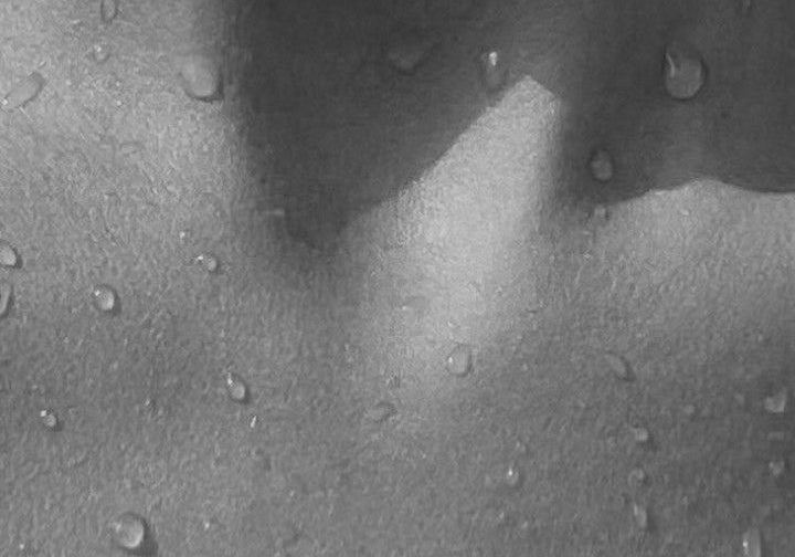 Black and white close up of water droplets on smooth skin across the collarbone and chest, evoking hydration and skin care results often associated with cosmetic treatments.