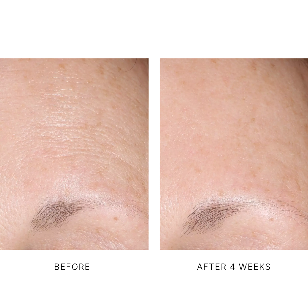 AlphaRet Overnight Cream