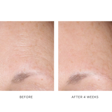 AlphaRet Overnight Cream