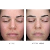 AlphaRet Clearing Serum