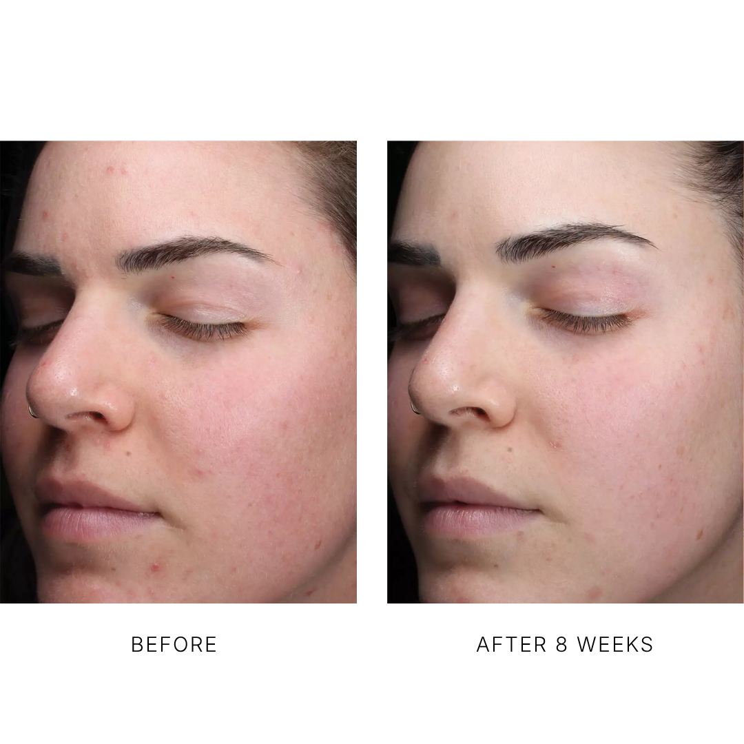 AlphaRet Clearing Serum
