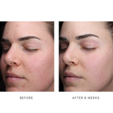 AlphaRet Clearing Serum