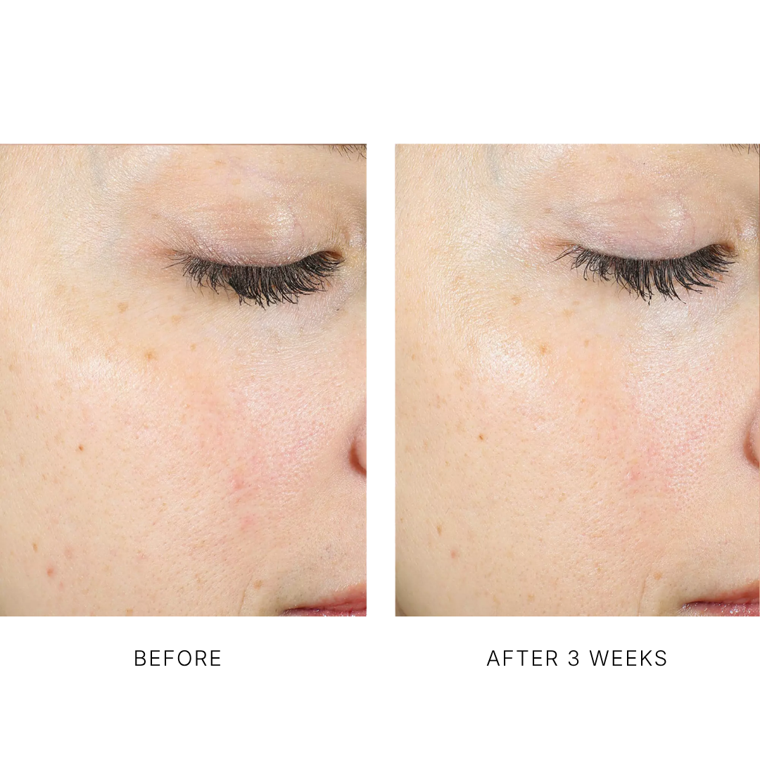 AlphaRet Exfoliating Peel Pads