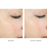 AlphaRet Exfoliating Peel Pads