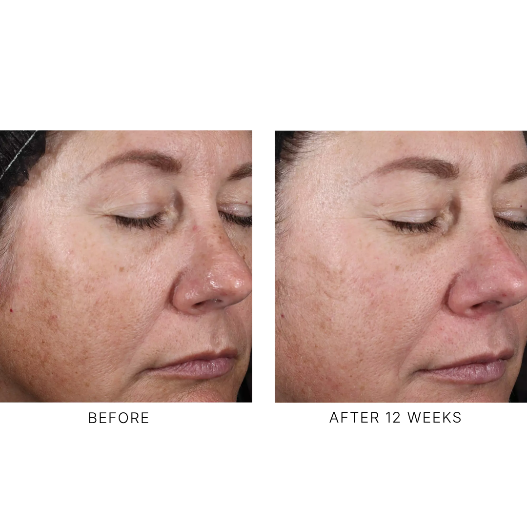 Alto Advanced Defense and Repair Serum