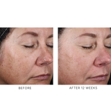Alto Advanced Defense and Repair Serum