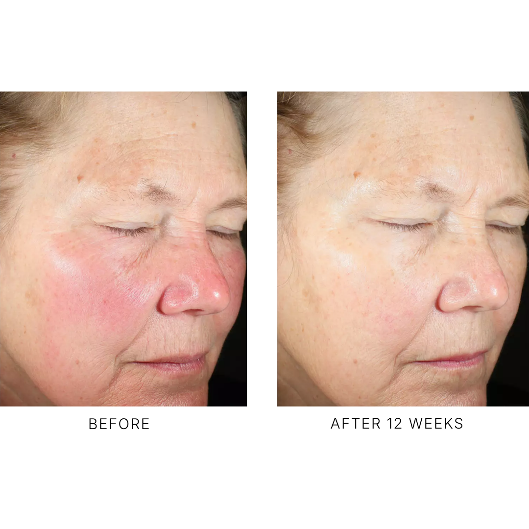 Even Intensive Skin Tone Correcting Serum