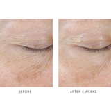 InterFuse Treatment Cream Eye