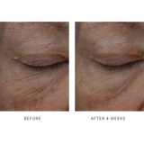 InterFuse Treatment Cream Eye